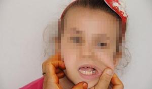 ogretmen-ogrencinin-disini-kirdi-iddiasi