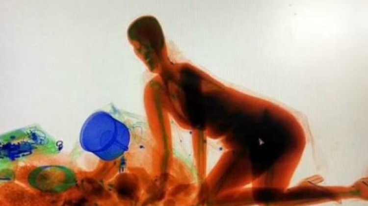 Milyonluk tablo değil! Çinli kadın X-Ray'de