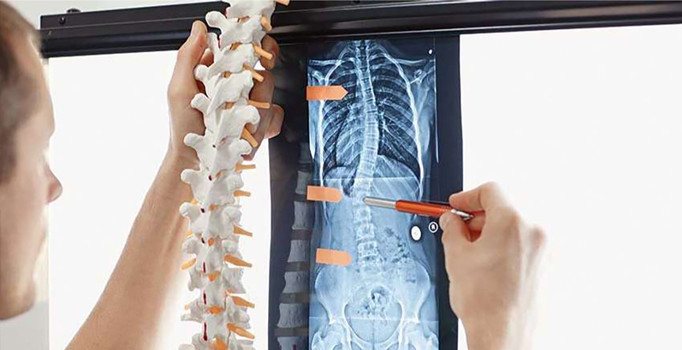 Felce karşı 3 boyutlu zafer