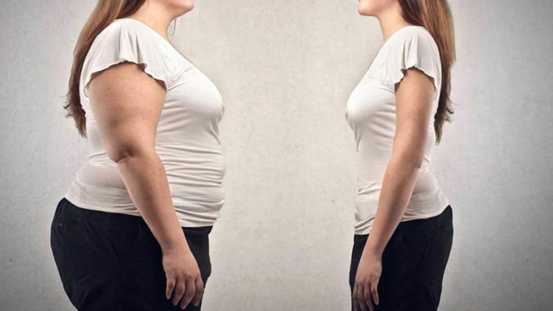 'Mide botoksu olanlar, 4- 6 ayda 20 kiloya kadar zayıflayabiliyor'