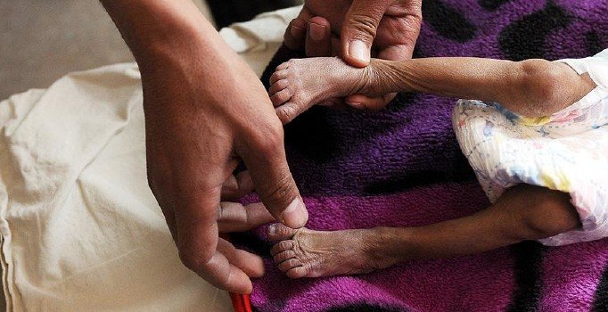 Almanya'dan Yemen için 100 milyon avro yardım sözü