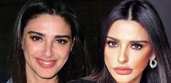 Aslıhan Doğan Turan'ın 'dudak' değişimi