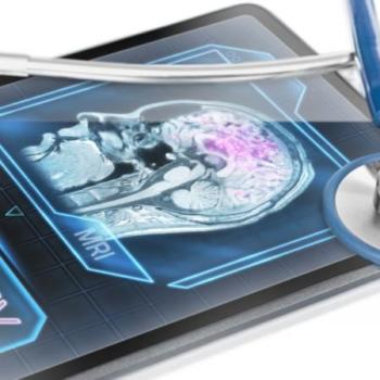 Epilepsi hakkında doğru sanılan 10 yanlış!