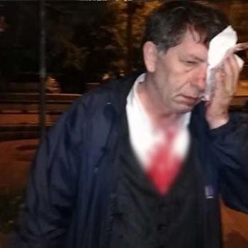 Gazeteci Yavuz Selim Demirağ'a saldıranlar serbest bırakıldı