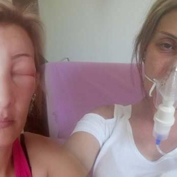 Kuaförde saçları 7 saat boyunca boyalı bırakılan kadın ölümden döndü