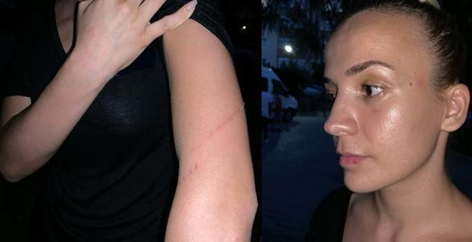 İstanbul'da servis şoförü dehşeti: Genç kadını darp etti