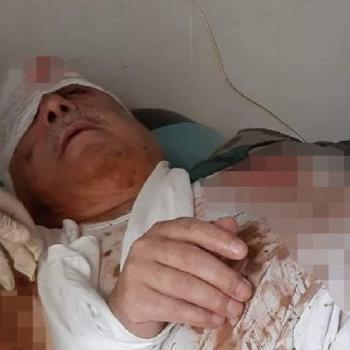 Reyhanlı katliamının faili terörist Mihraç Ural, bombalı saldırıda ağır yaralandı