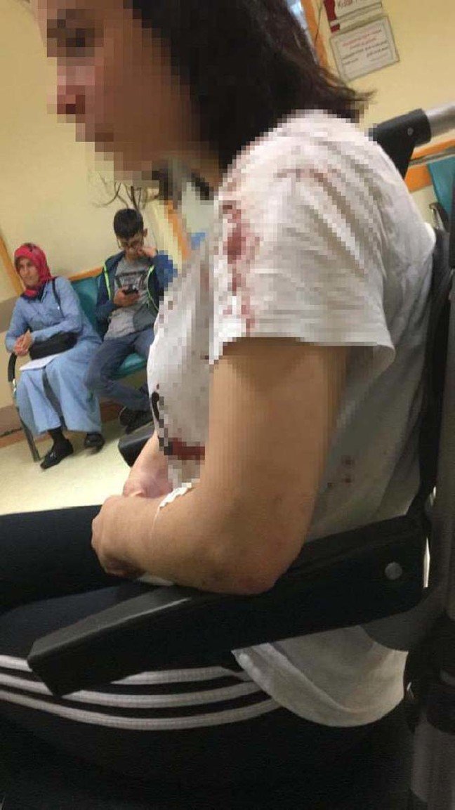 rizedeki-saldirida-yaralanan-rabia-dhaya-konustu-bogarak-oldurucekti_1516_dhaphoto18 19-07/29/rizedeki-saldirida-yaralanan-rabia-dhaya-konustu-bogarak-oldurucekti_1516_dhaphoto18.jpg